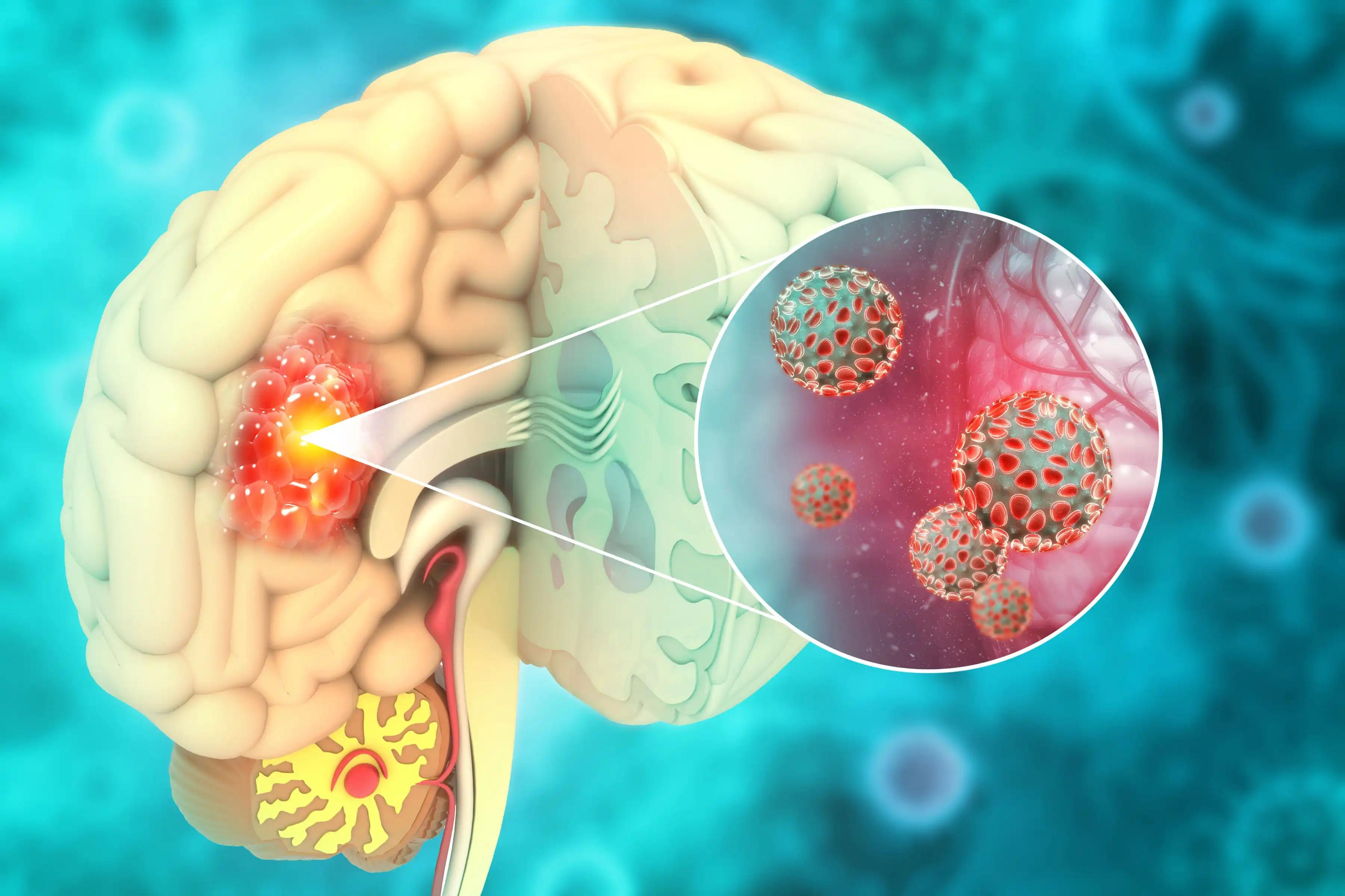 Efficacy of Immunotherapy for HGG: A Meta-Analysis