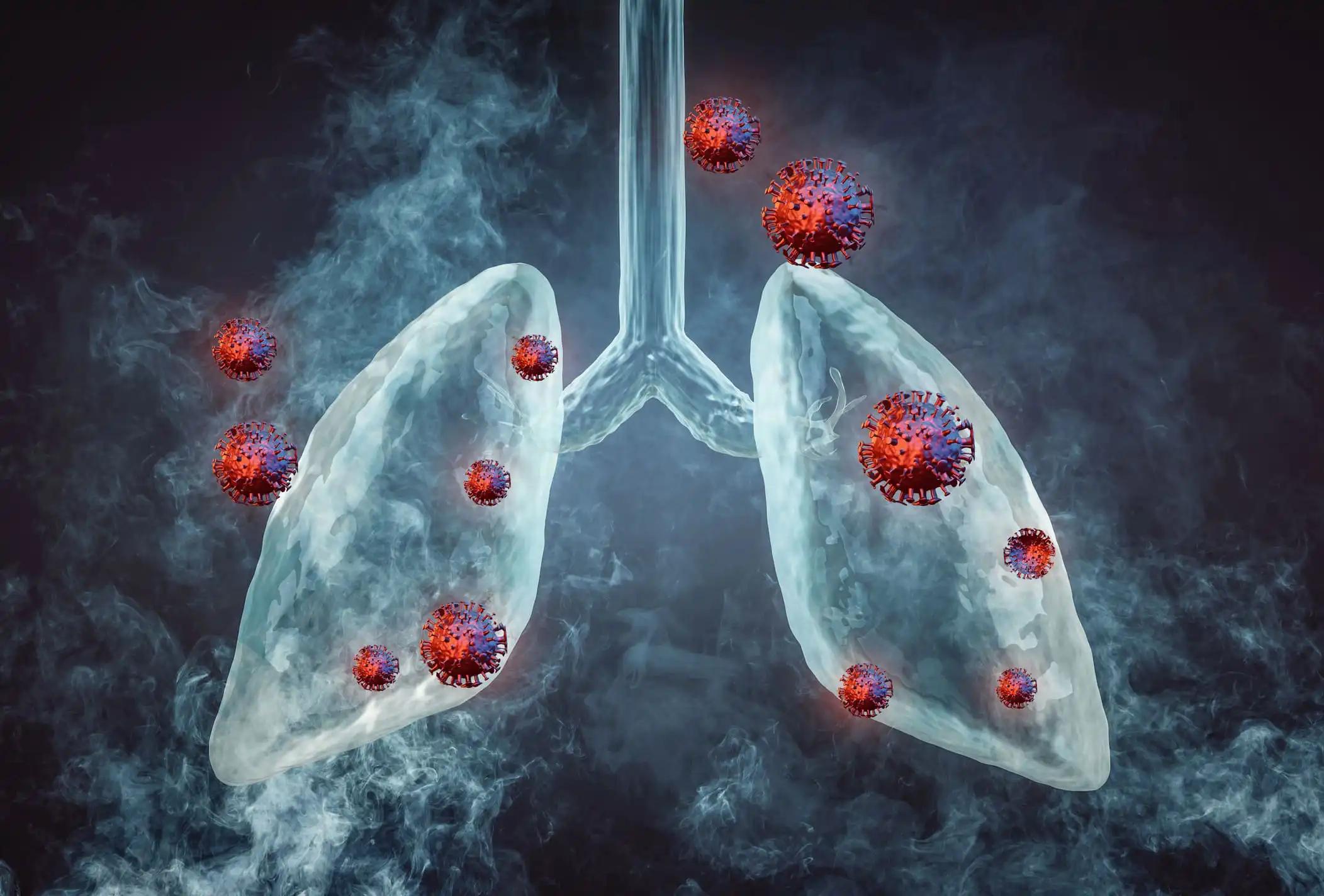 3D View of Cancer Virus Attacking On Lungs