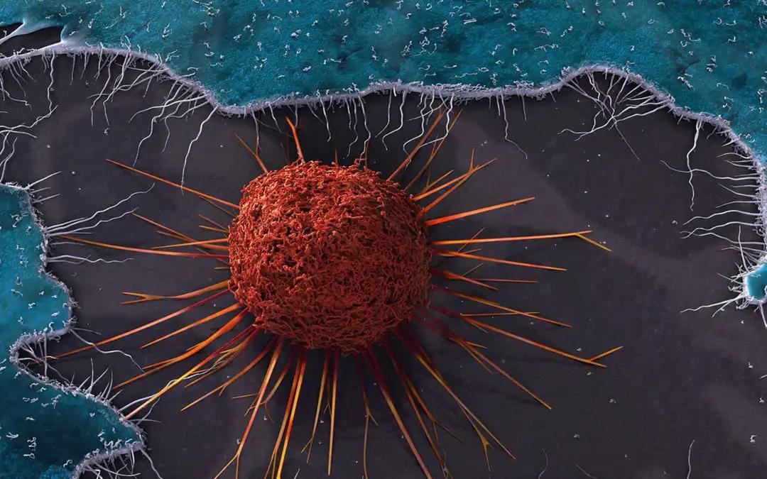 Tracking CD8+ T Cells & Macrophages in CC during CCRT