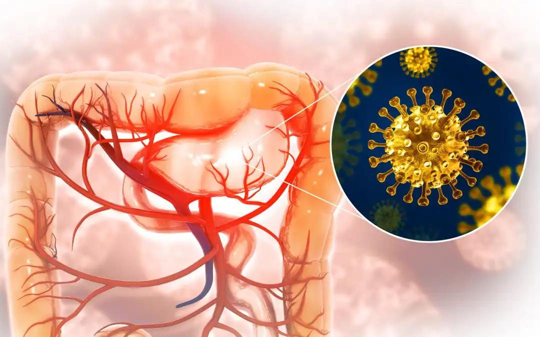 Impact of High-Dose Vitamin D on mCRC With Chemo+Bev