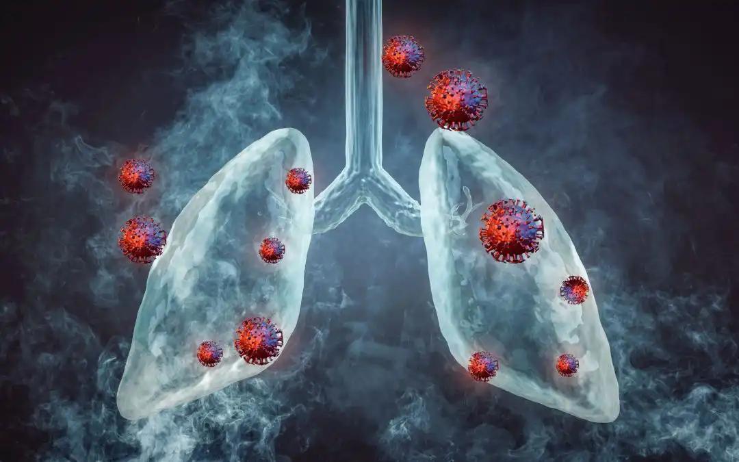 Correlation Between Clinical and HRQoL Benefits in ALK+ NSCLC: ALTA-1L Study