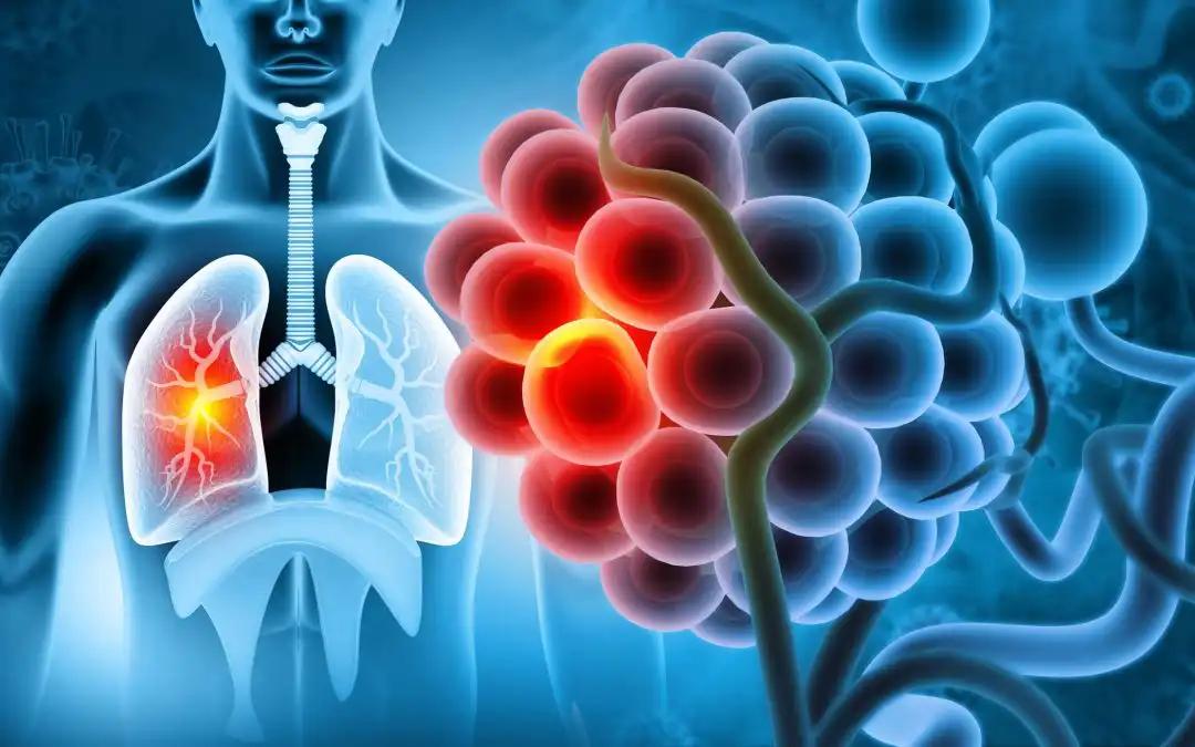 TAN Dynamics: NSCLC Treatment & TME Insights