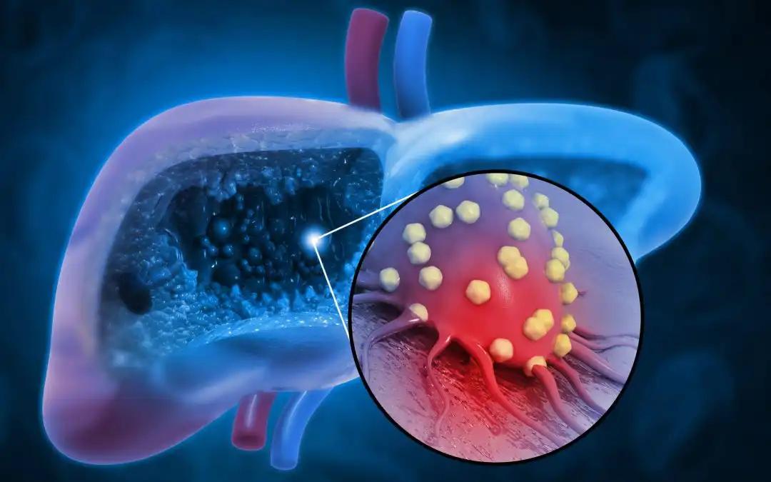 Impact of BPA on HCC Immune Microenvironment and Progression