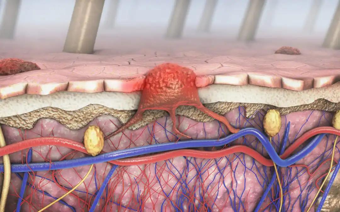 New Tech in CM Diagnosis & Prognosis: Expert Panel Review