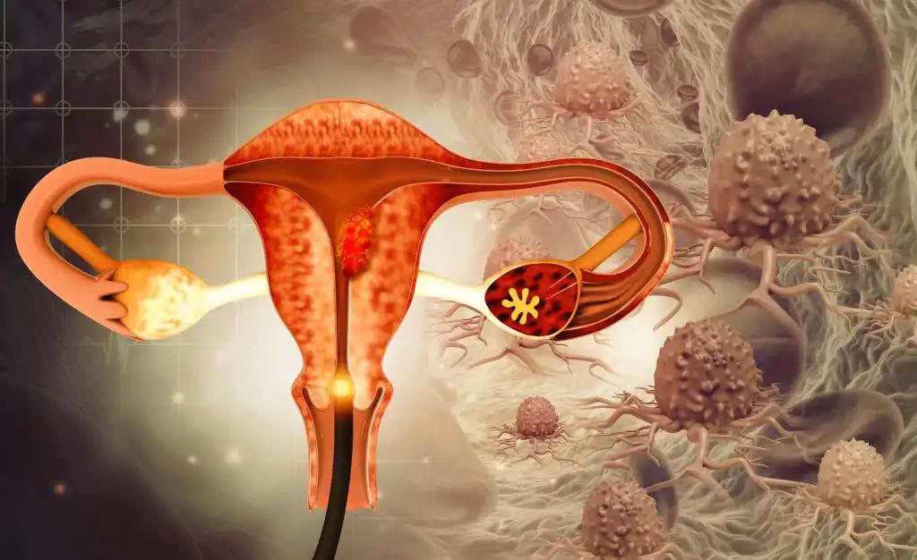Dilation and Curettage (d and c) Endometrial Biopsy