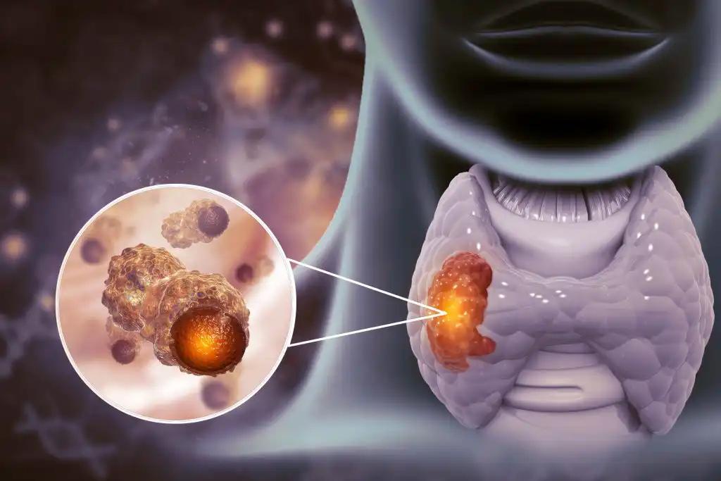 Virus Infection Esophageal Cancer