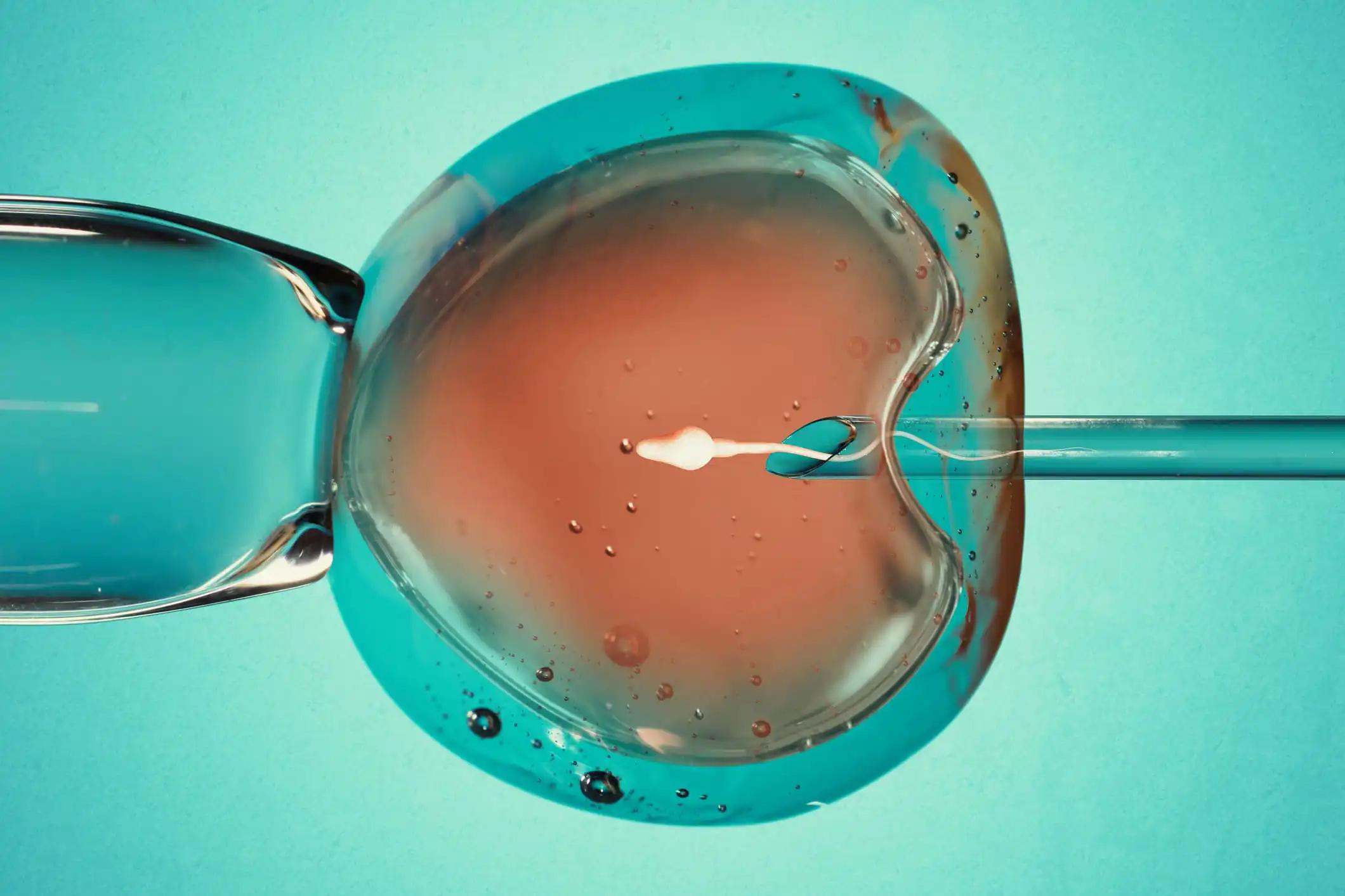 Artificial Insemination or Fertility Treatment