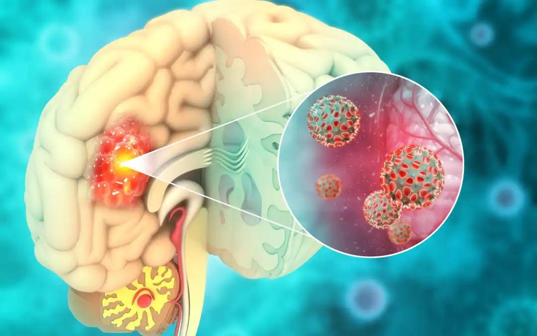 Efficacy of Immunotherapy for HGG: A Meta-Analysis