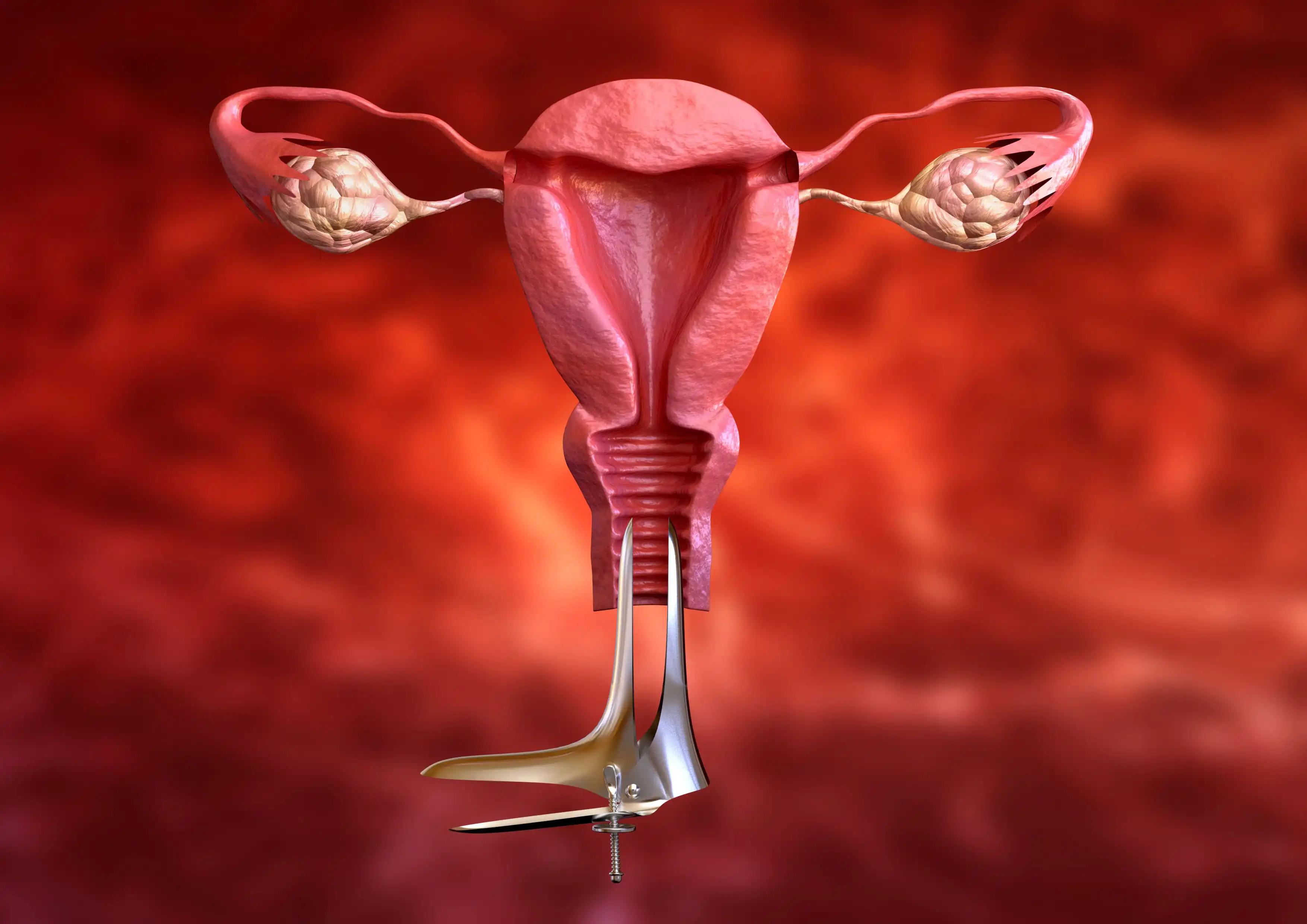 Cervical Cancer Screening Through Pap Smear Test
