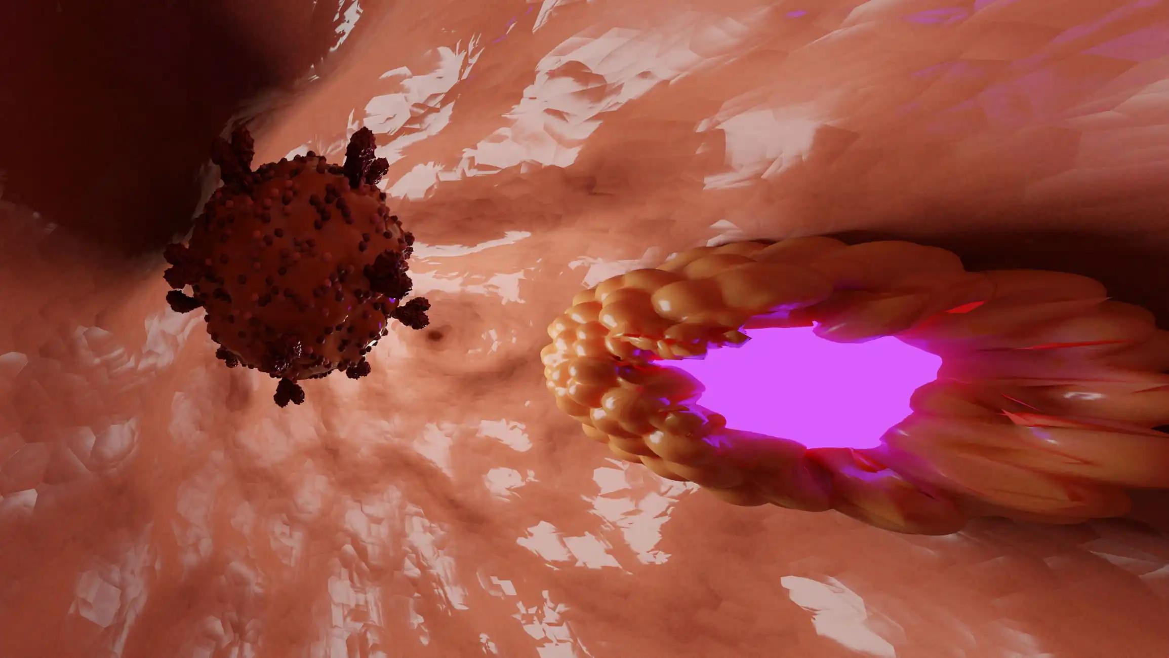 Close-up View of Prostate Cancer Cells in Body