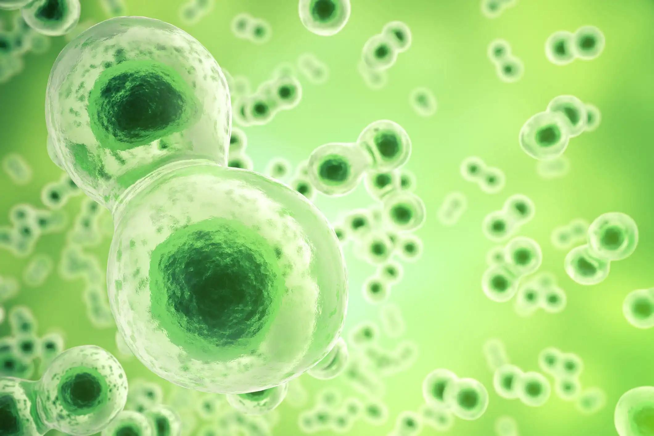 Lung Carcinoma Tumor Cells