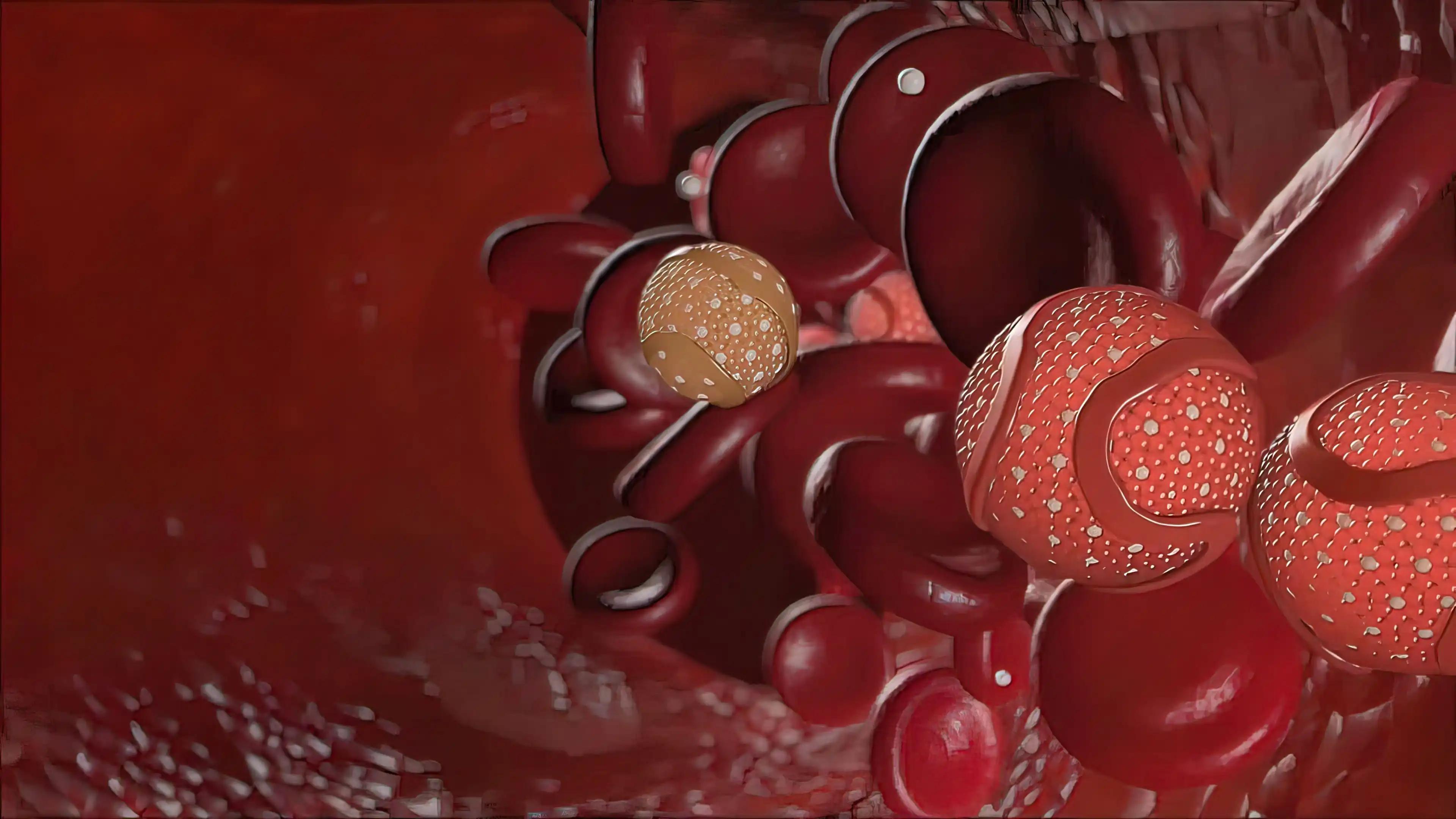 Lymphoma Blood Cells in Vein