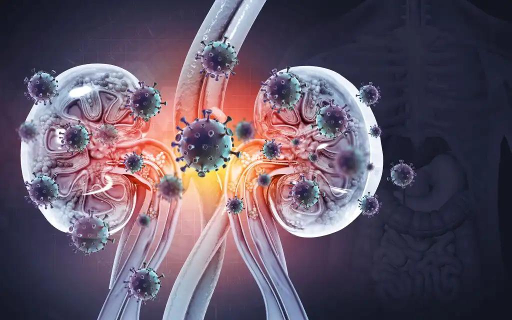 3D View Of Cancer Cells on Kidney