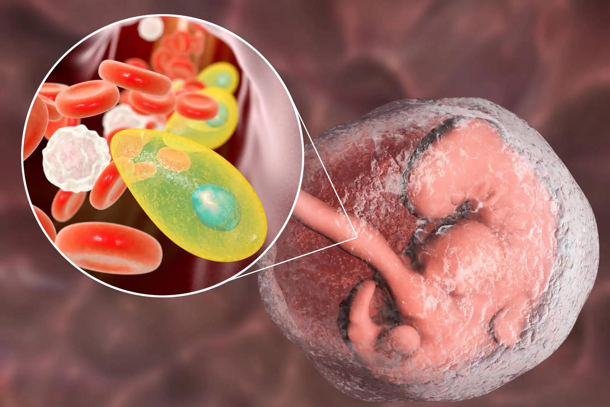 Toxoplasma Gondii Parasite to Human Embryo