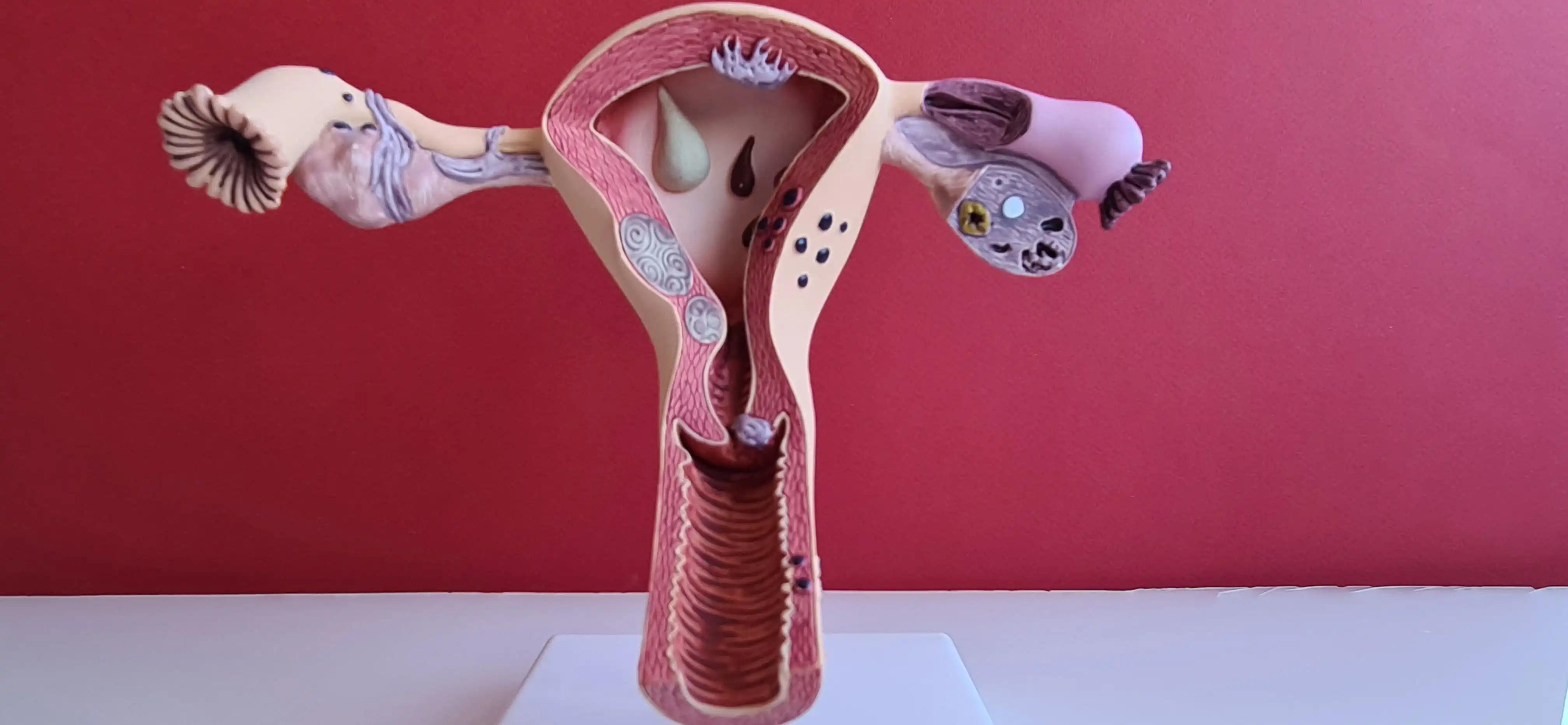 Uterus and Reproductive System of Woman