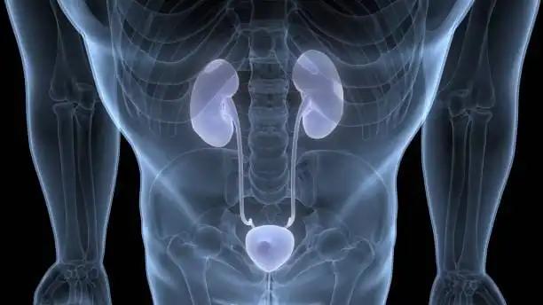 X-ray of Male Kidneys and Bladder