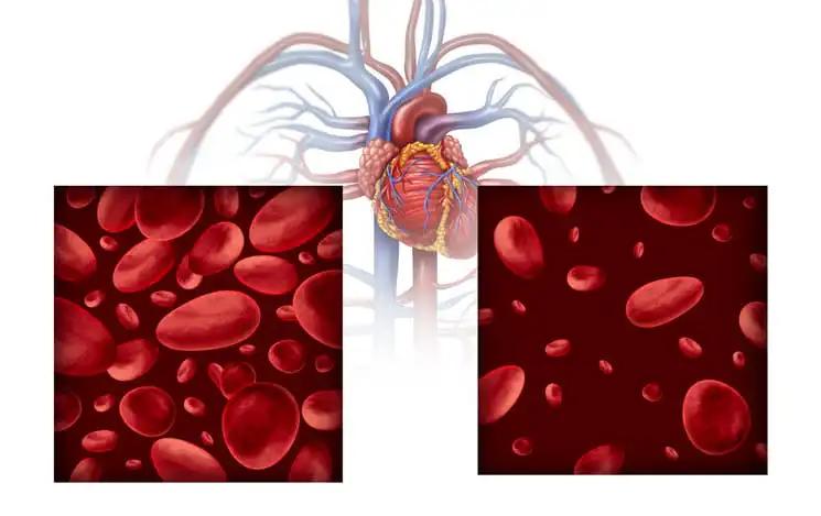 Anemia Abnormal Blood Cell Count and Human Circulation in an Artery