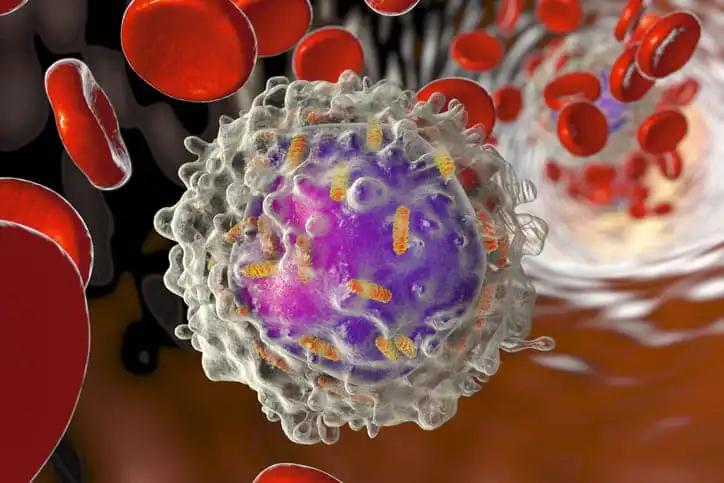 Stem Cells and Reprogramming in Human Acute Leukemia