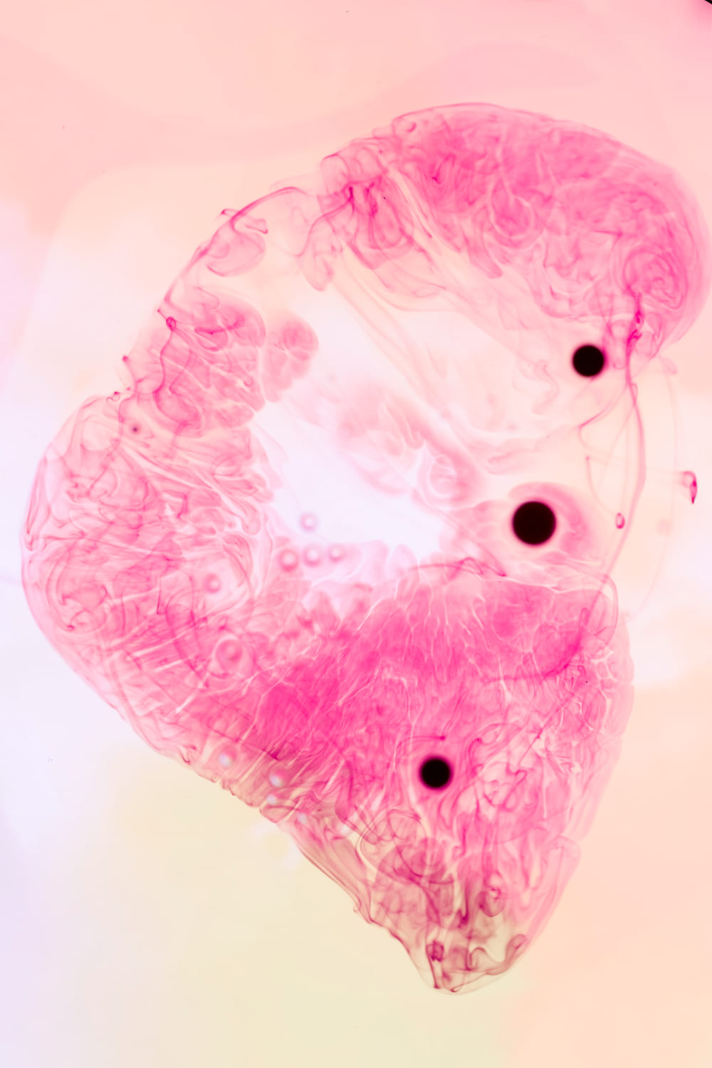 A Dark, Irregular Mass in the Lower Right Lobe of Lung