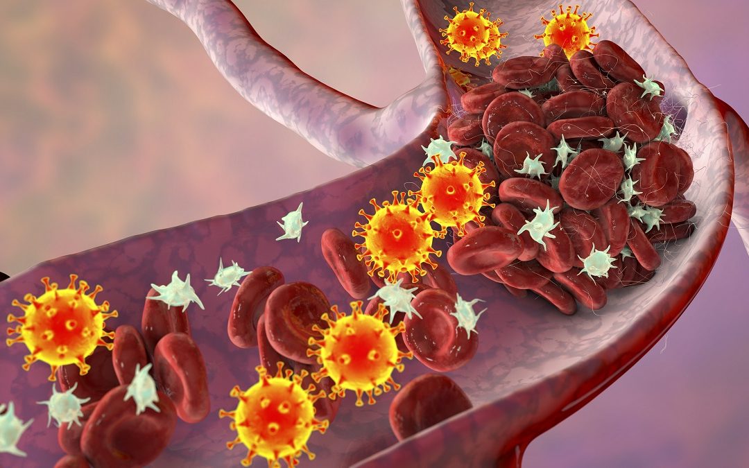 18F-FDG PET/CT and Nomogram Enhance EBV-HLH Diagnostic Precision