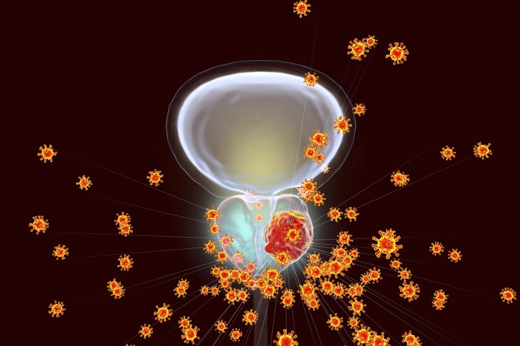 3D illustration of Viruses Infecting Prostate Gland Develops Cancerous Tumor