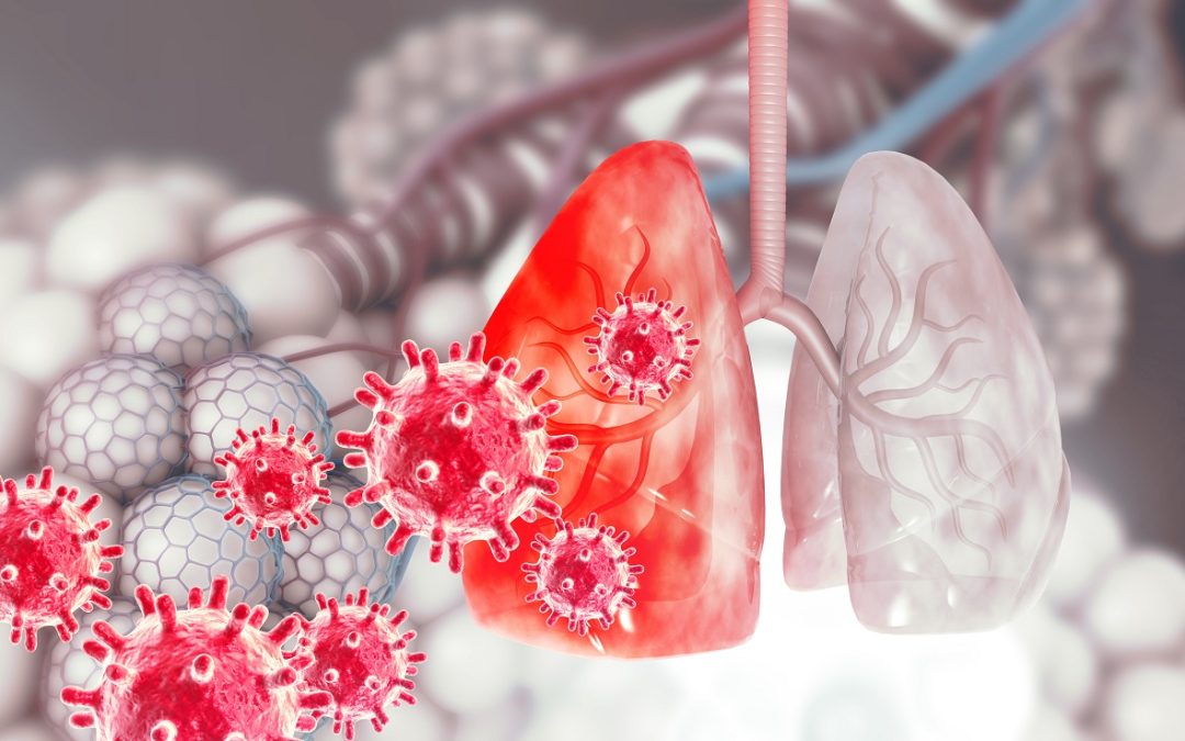 EGFR Mutations in Resected Early-Stage NSCLC Patients