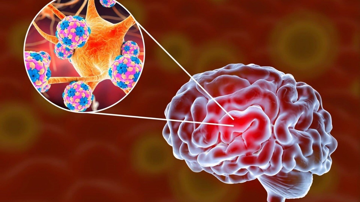 3D illustration of Brain Viruses and Neurons