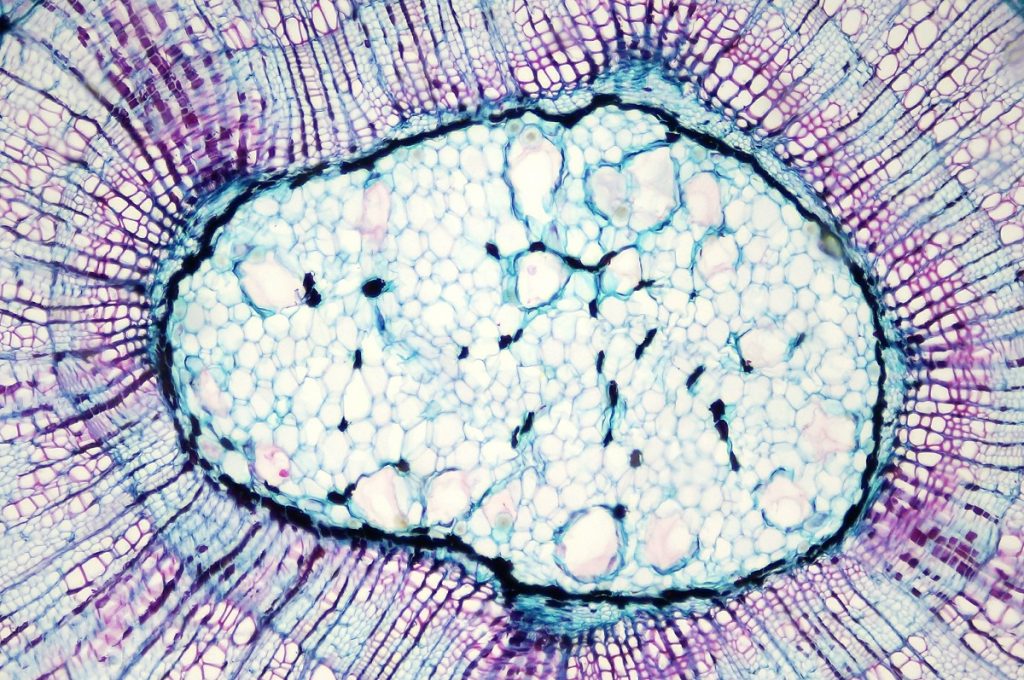 Head Cancer Cells Under Microscope