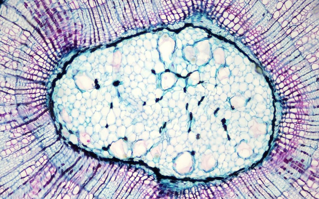 Areca Nut Promotes Oral Cancer by Activating M2 Macrophages