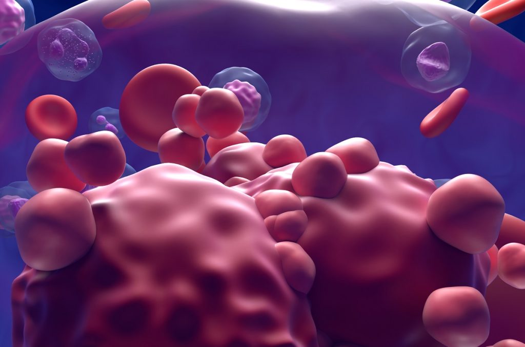 3d illustration of Acute lymphoblastic Leukemiacancer Cells in Blood