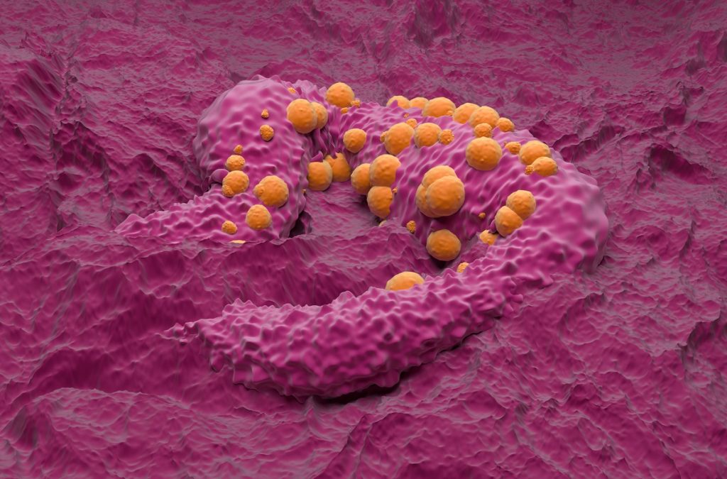 3D illustration of Basal Cell Carcinoma Tissue