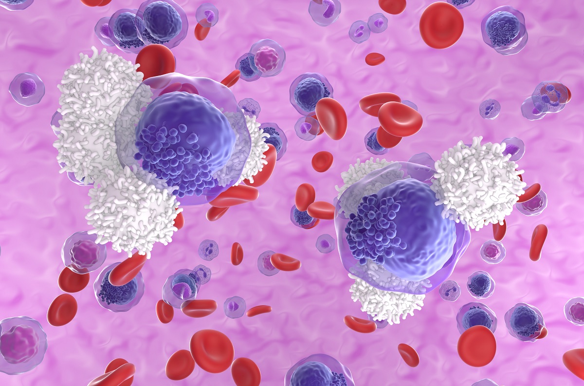 3D Illustration of T-cells Attack Acute Myeloid Leukemia Cells