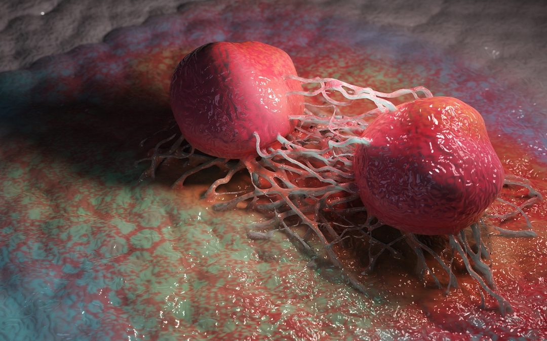 Autophagy-Related Genes in Tongue Cancer Affected by PP