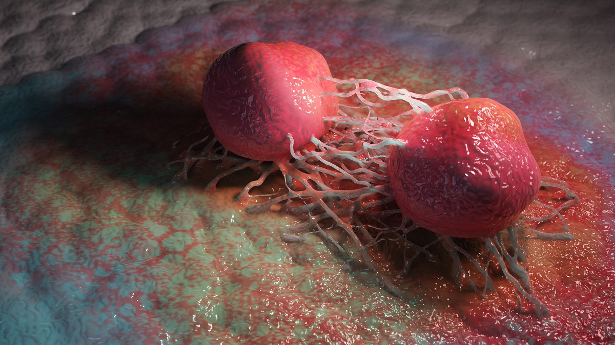 3D Rendered of HNACC Malignant Cells
