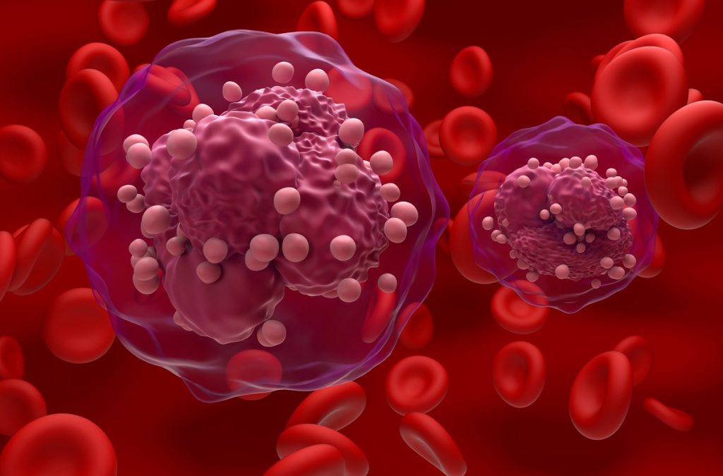 3d illustration of Acute lymphoblastic leukemia Cancer Cells in Blood Flow