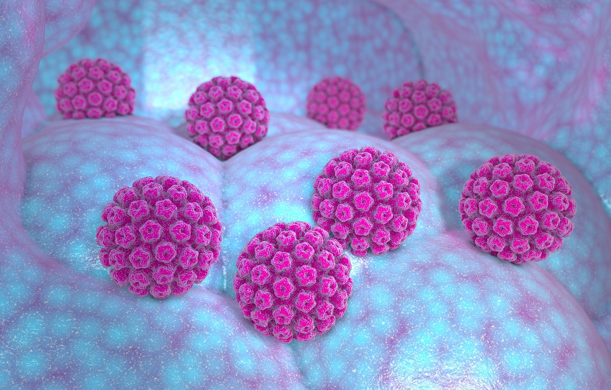 Non-Central Pelvic Recurrent Cervical Cancer Cells